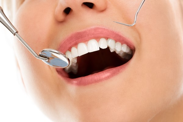 A Comprehensive Guide to Know About The Oral Hygiene Services
